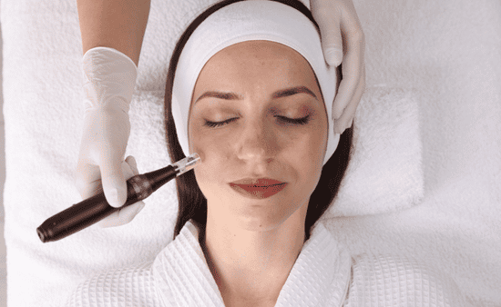 Understanding Microneedling